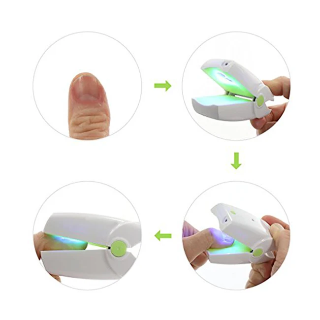 Tratament cu laser pentru ciuperca unghiei - te scapă de micoza unghie – dermachom-ro